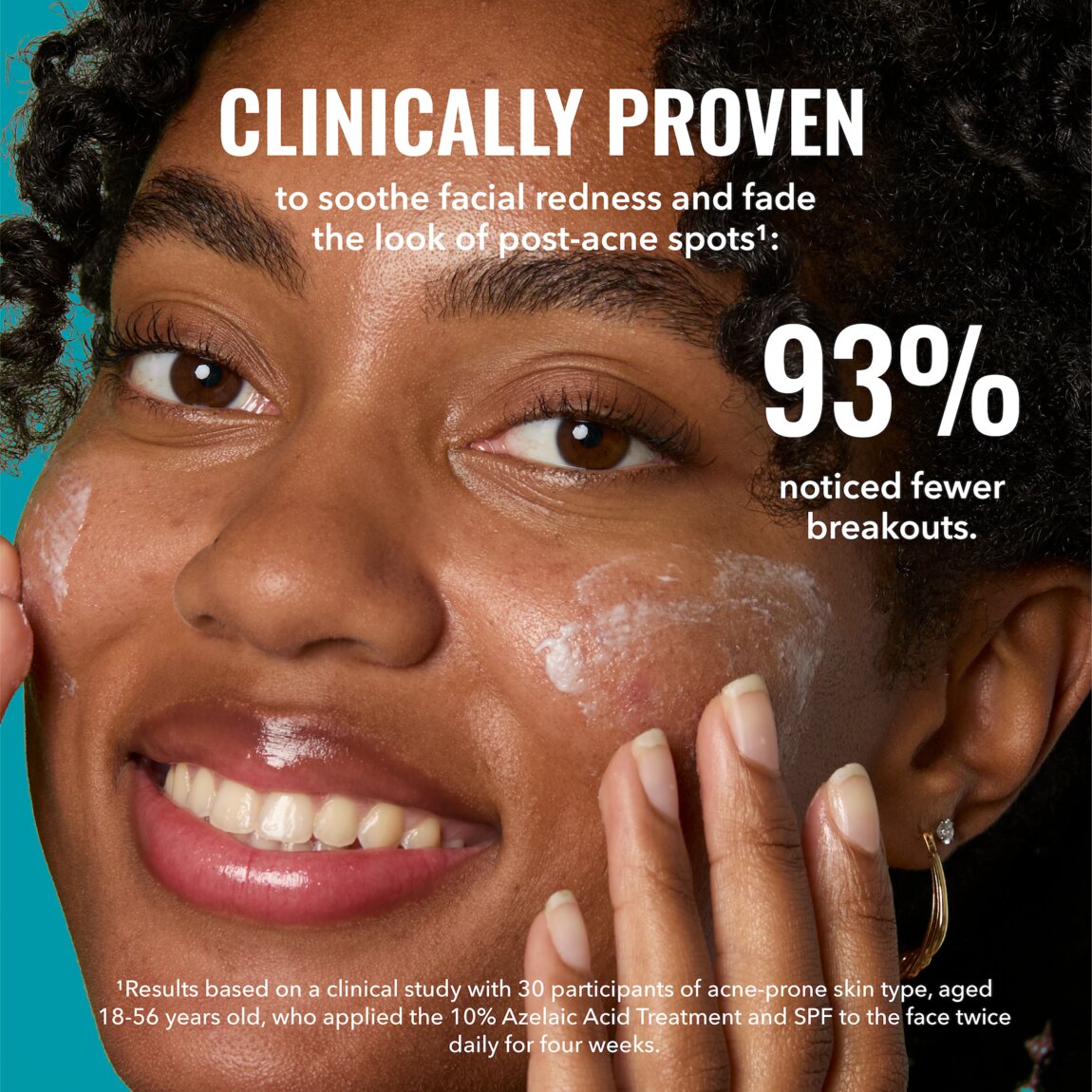 10-azelaic-acid-treatment-h4 zb_p.jpg