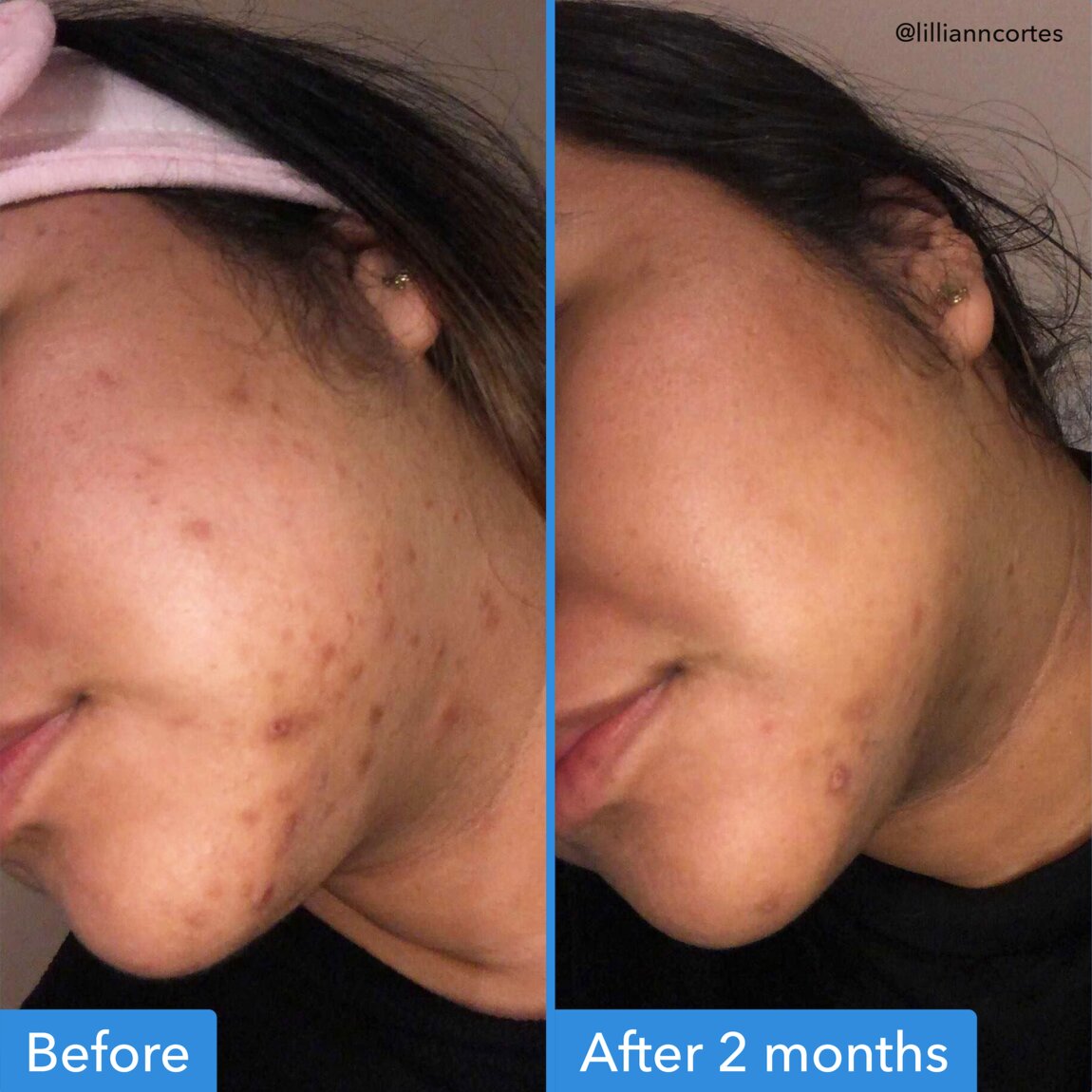 discoloration-correcting-serum-k6 zb_p.jpg