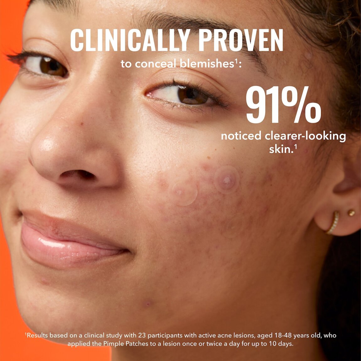 pimple-patches-d7 zb_p.jpg