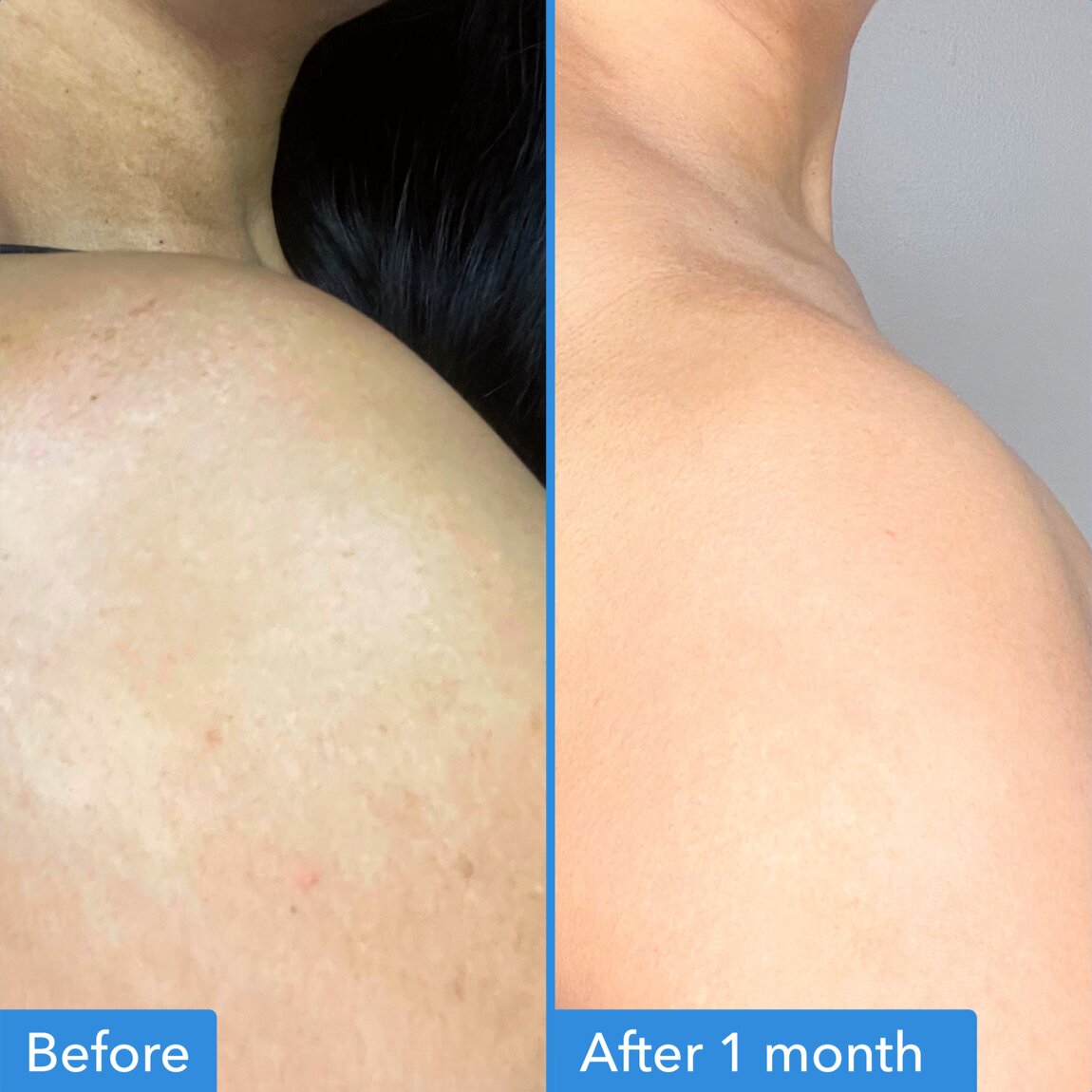 discoloration-correcting-body-treatment-w0 zb_p.jpg