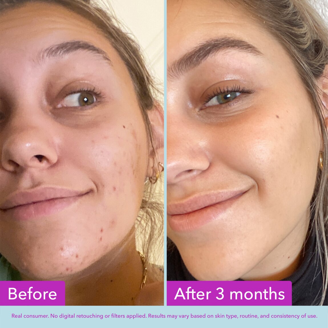niacinamide-brightening-toner-p3 zb_p.jpg